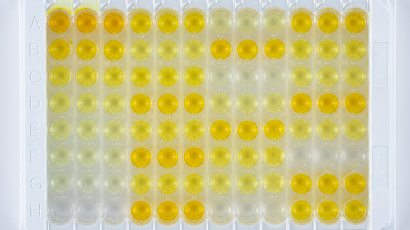 /sites/default/files/styles/placeholder/public/images/elisa-assist-plus-9493_0.jpg?itok=EycbEJWt