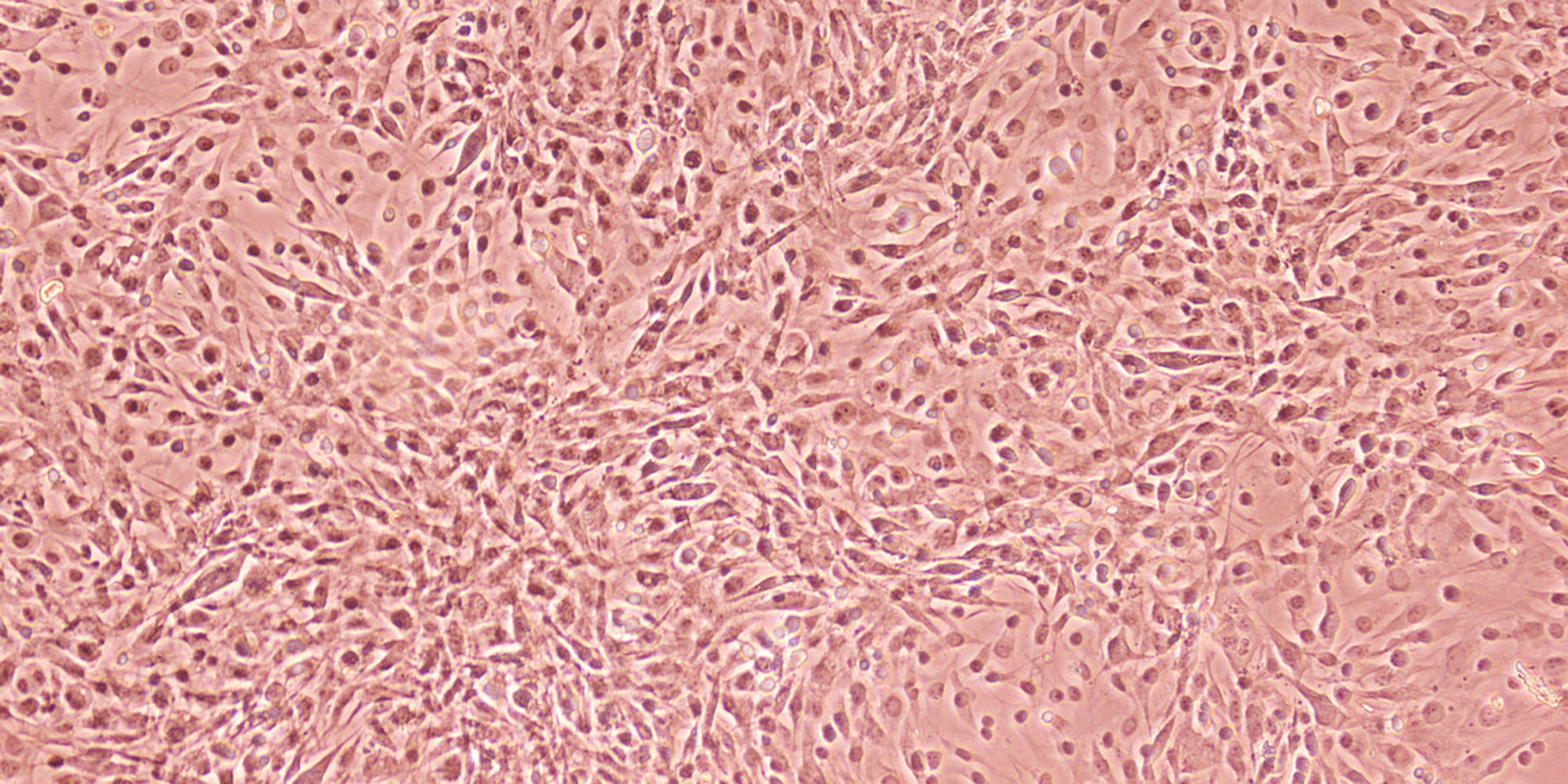 Adherent cell culture
