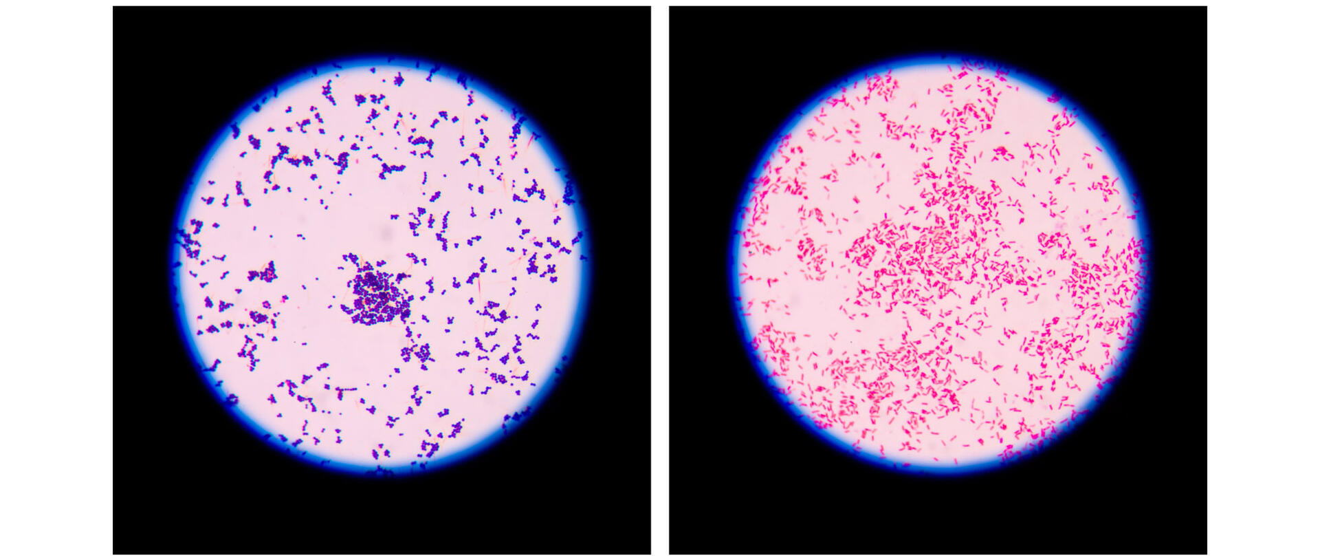 Crystal violet Gram stain: Gram-positive bacteria (left) retain the stain and appear blue, Gram-negative bacteria (right) don't retain it and appear red