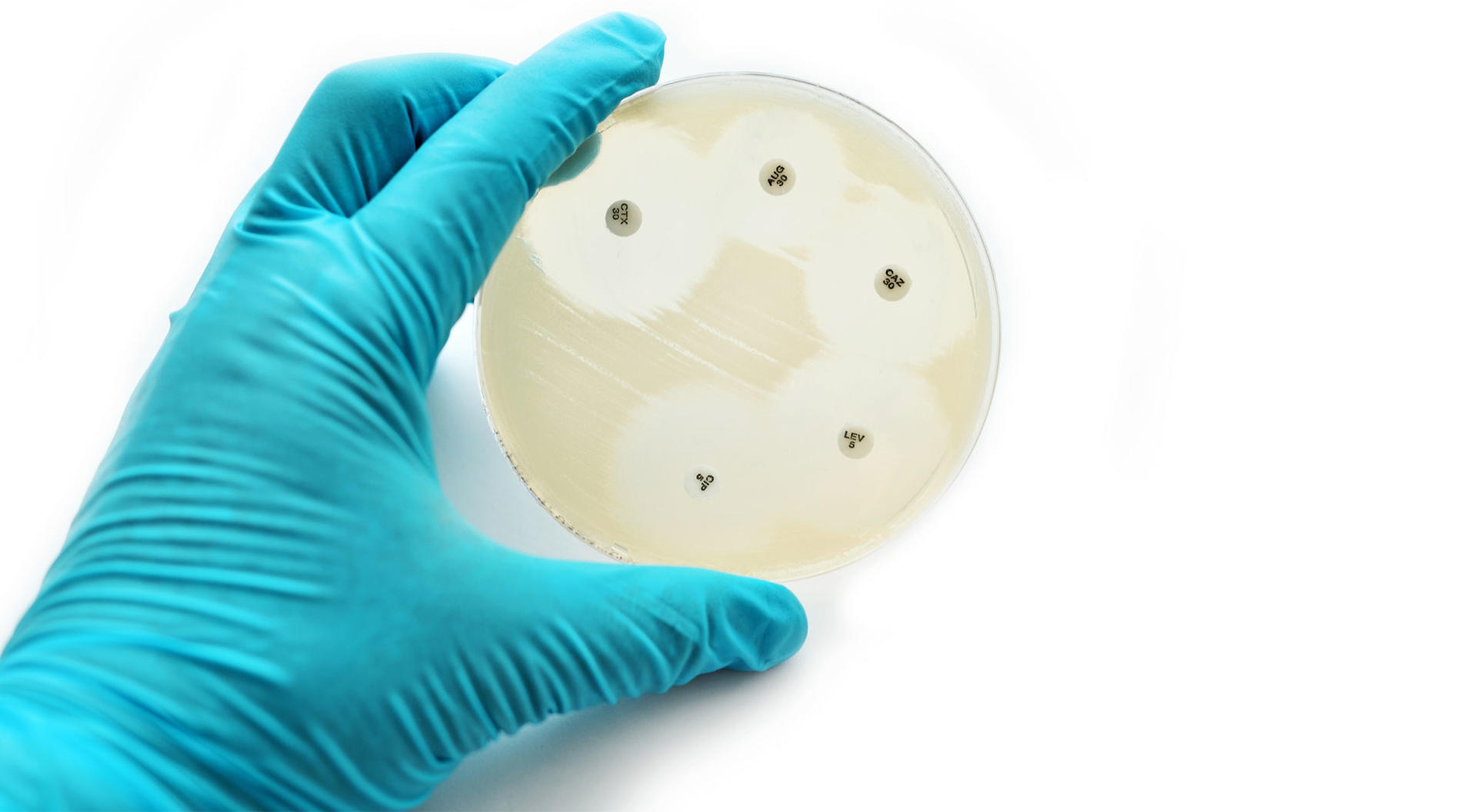 Antimicrobial susceptibility testing: Petri dish with 5 paper disks and the zones of inhibition around them