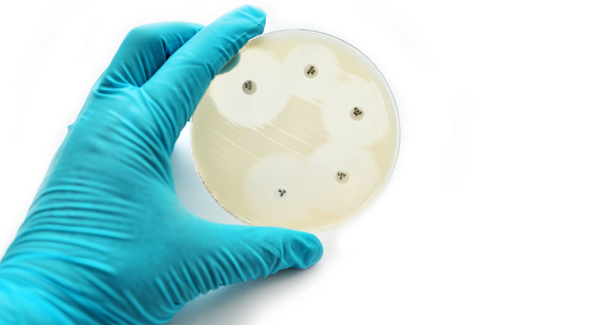 Petri dish with 5 paper disks and the zones of inhibition around them