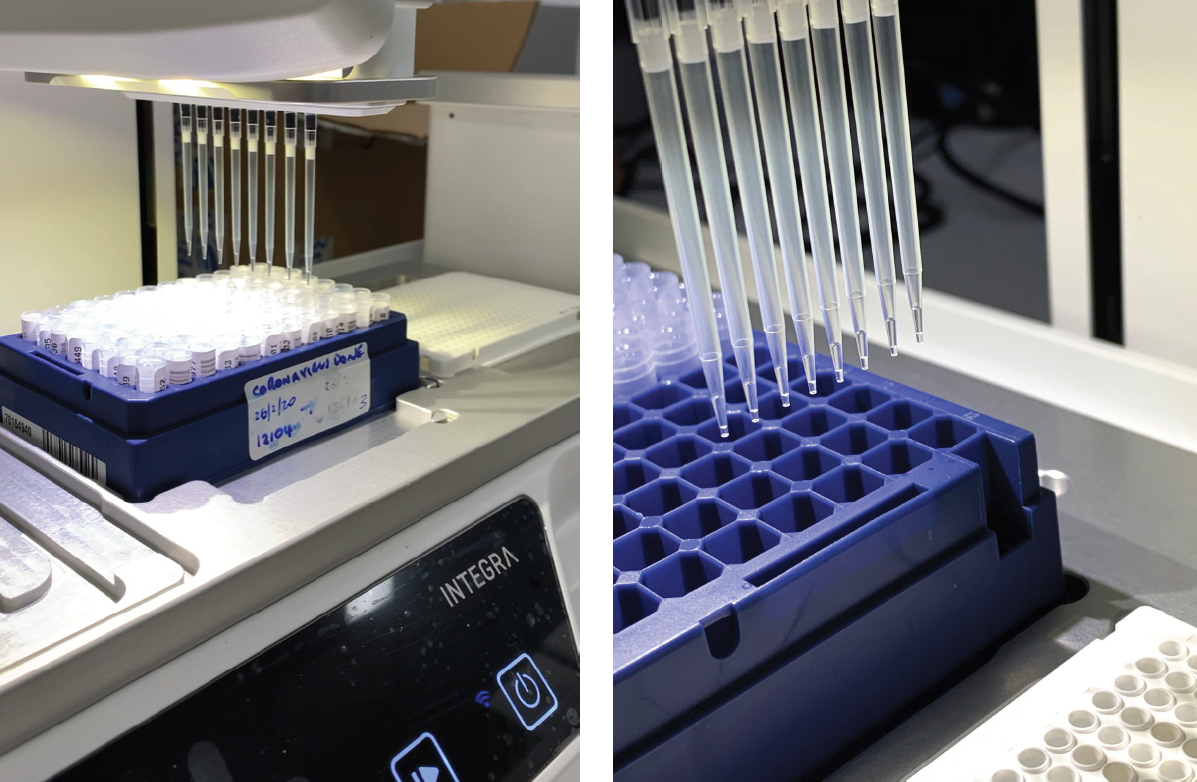 Figure 5: Automated RT-PCR testing for COVID-19 using the ASSIST PLUS pipetting robot together with a VOYAGER 8 channel adjustable tip spacing pipette, as performed in the Microbiology and Molecular Pathology Department at SNP.