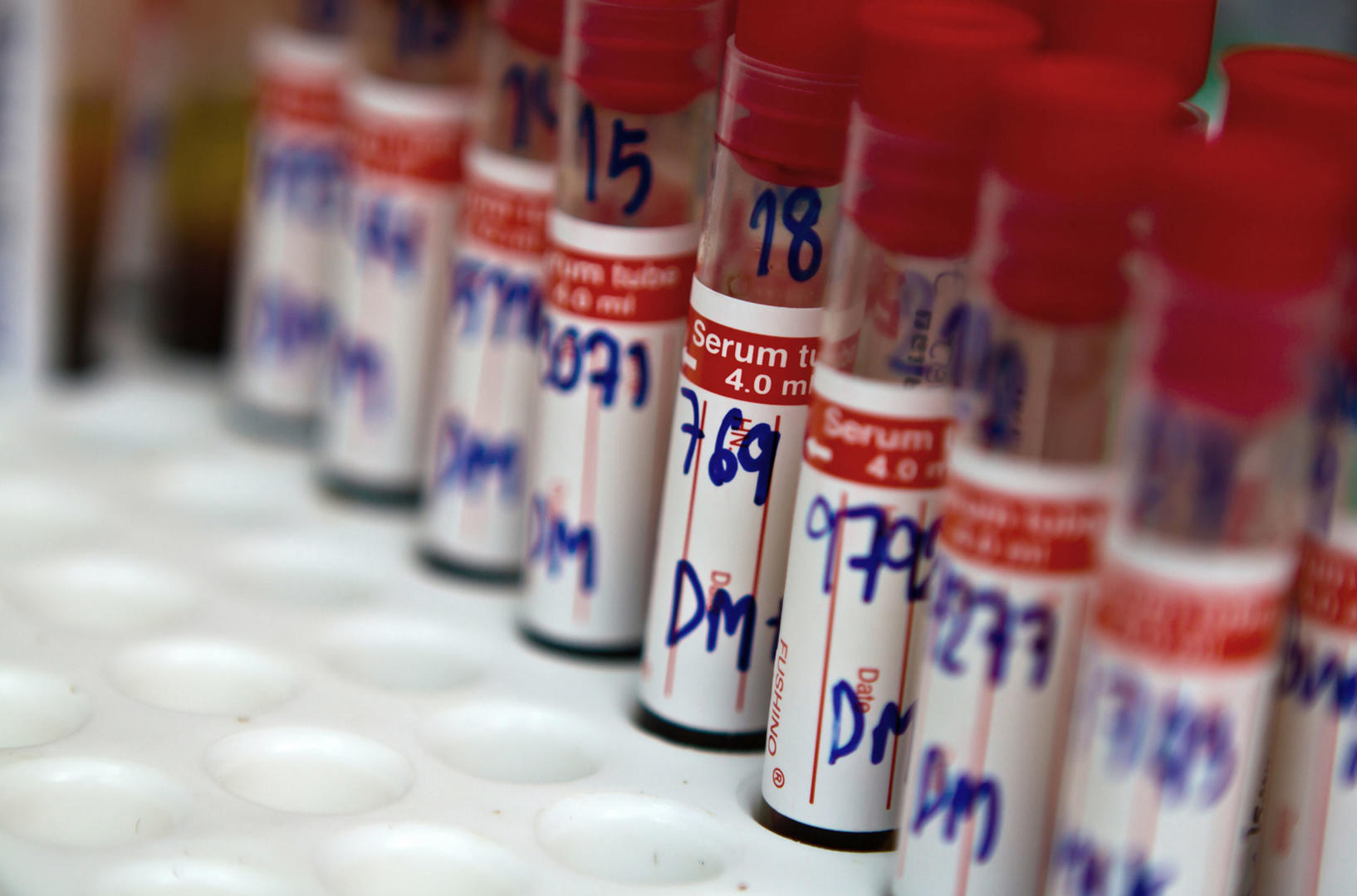 Sample labeling: Tubes with handwritten labels in a rack