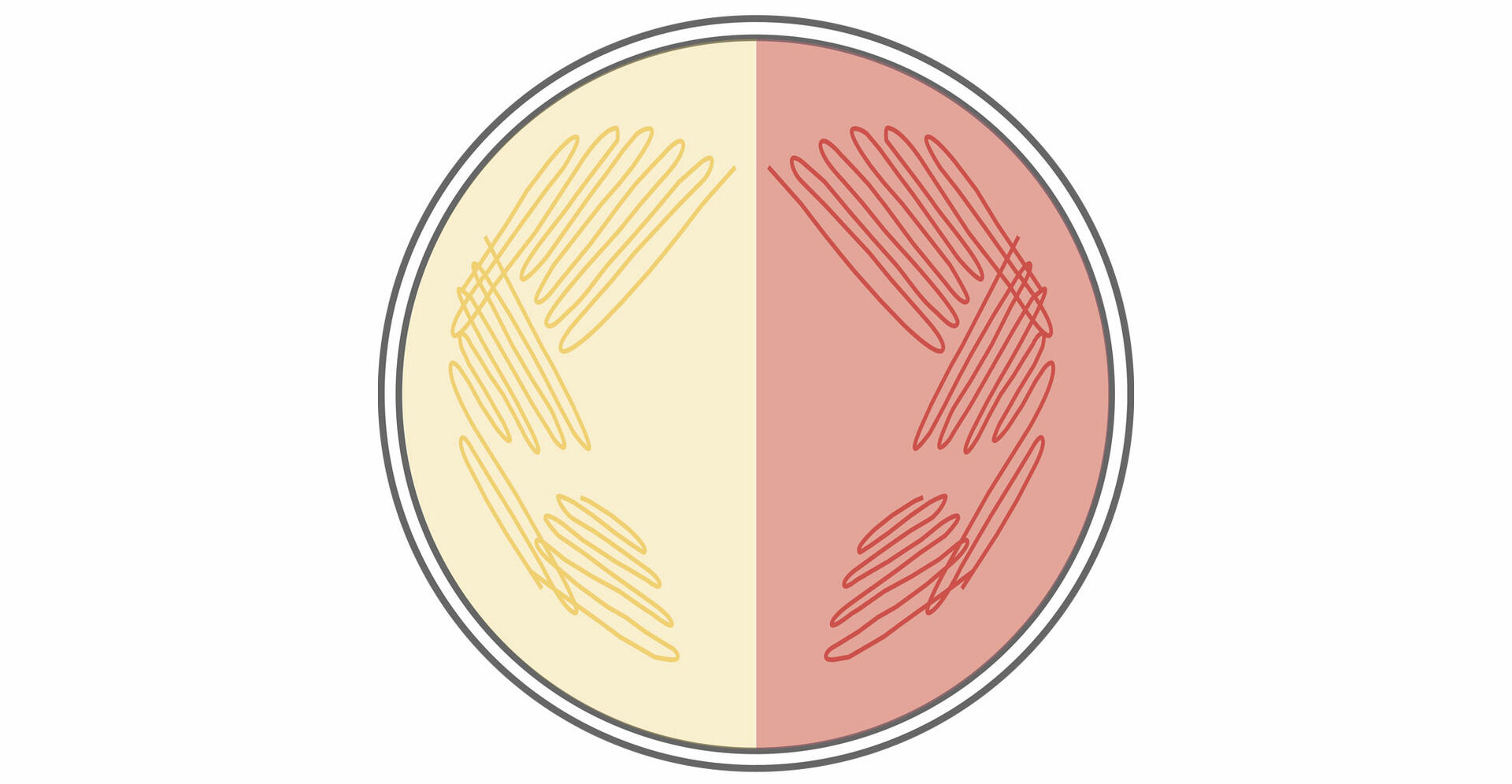Bacterial cultivation on MacConkey agar