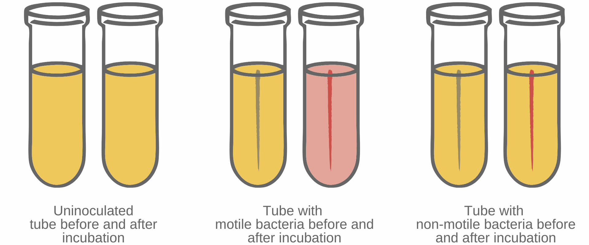 How to culture bacteria