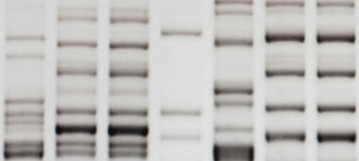 DNA fingerprint obtained by RFLP analysis