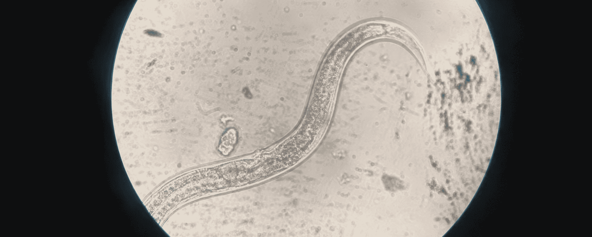 Nematode worm under the microscope