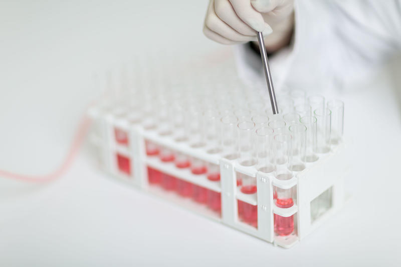 DOSE IT | ラボ用ペリスタルティックポンプ | INTEGRA