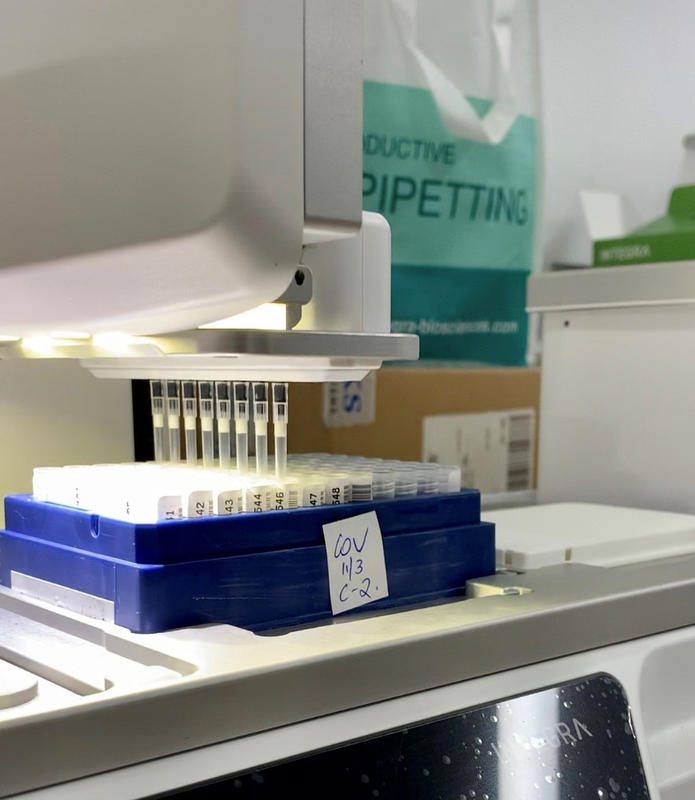 Close-up of the ASSIST PLUS pipetting robot testing patient samples for the coronavirus