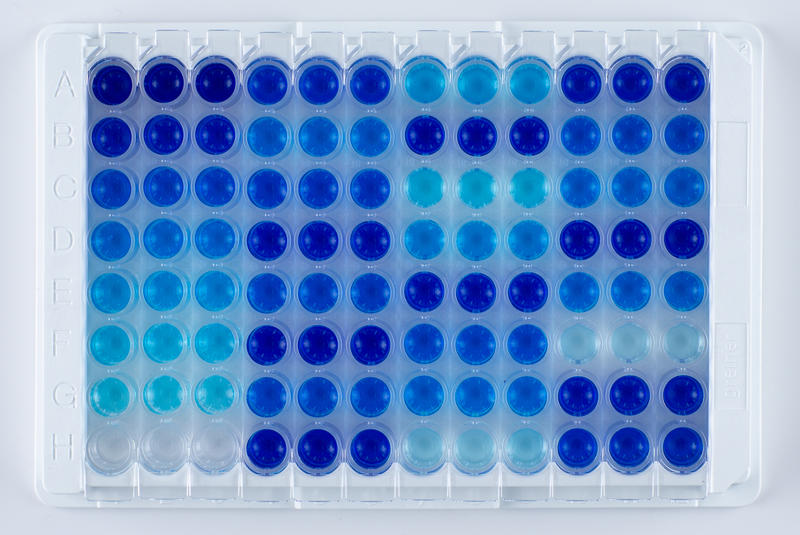 Liquid handling automation: Example of a sandwich ELISA plate