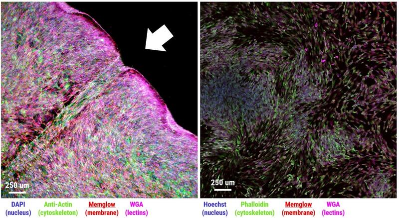 Fluorescence images comparing adipose-derived stem cells grown in 3D hydrogel Bio-Blocks versus 2D flasks.